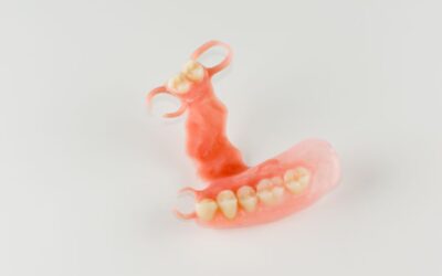 Riparazione Protesi in Nylon
