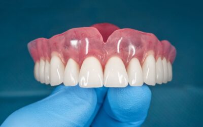 Riparazione dentiere in giornata